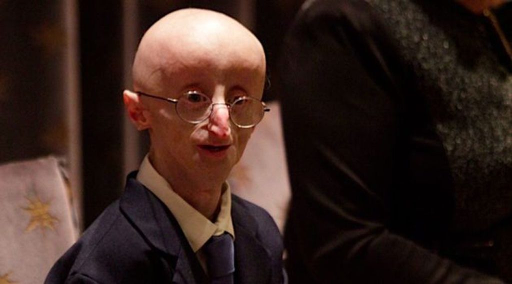 Sam Berns